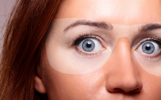 うっかり日焼け