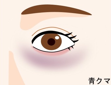 【青クマ】血行不良が原因！目元を温める＆マッサージが効果的