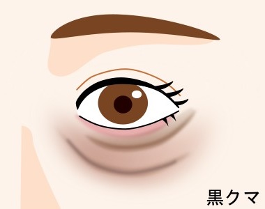 【黒クマ】たるみが原因！顔の筋トレ＆リフトアップケアが鍵